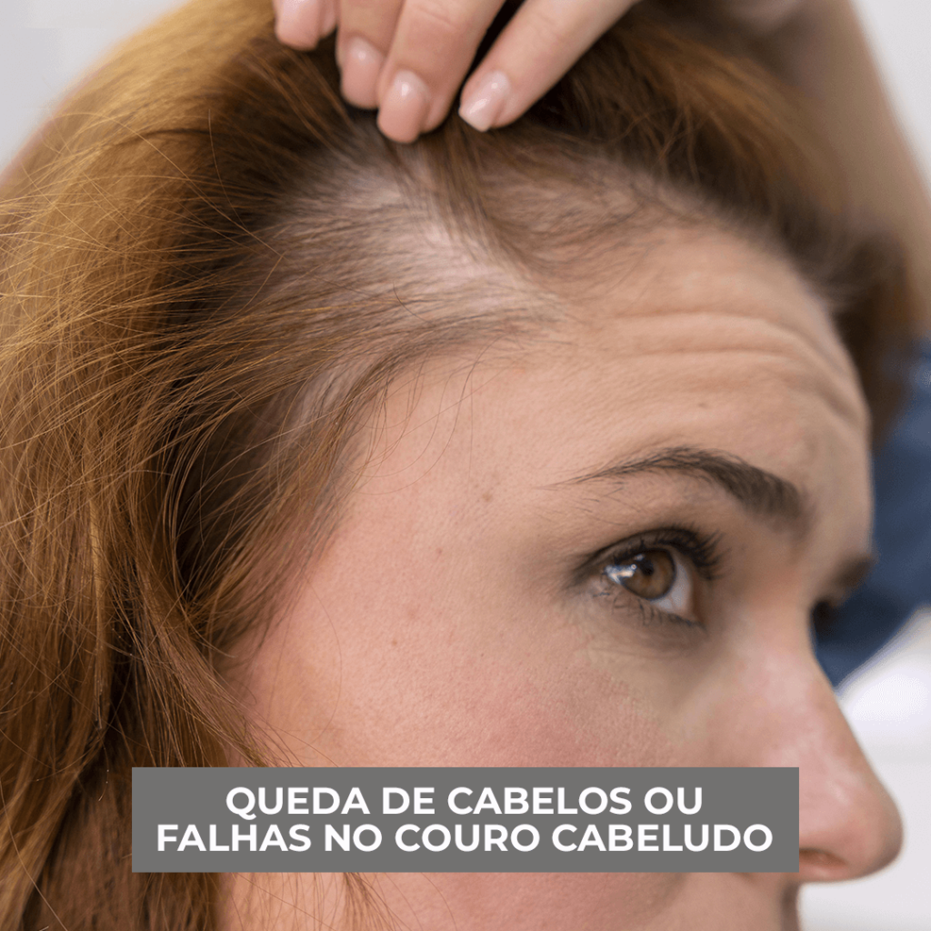 CABELO (1)