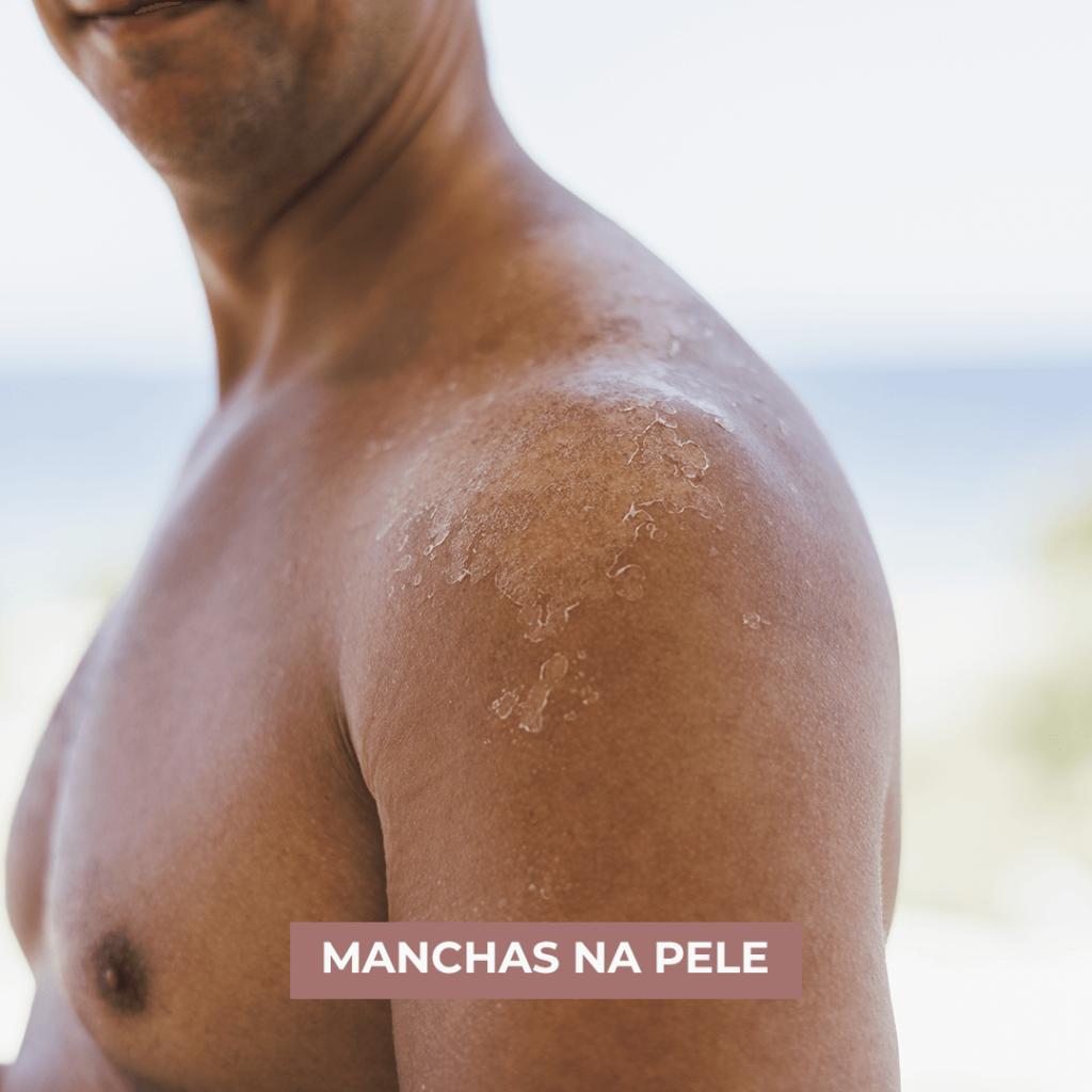 MANCHAS