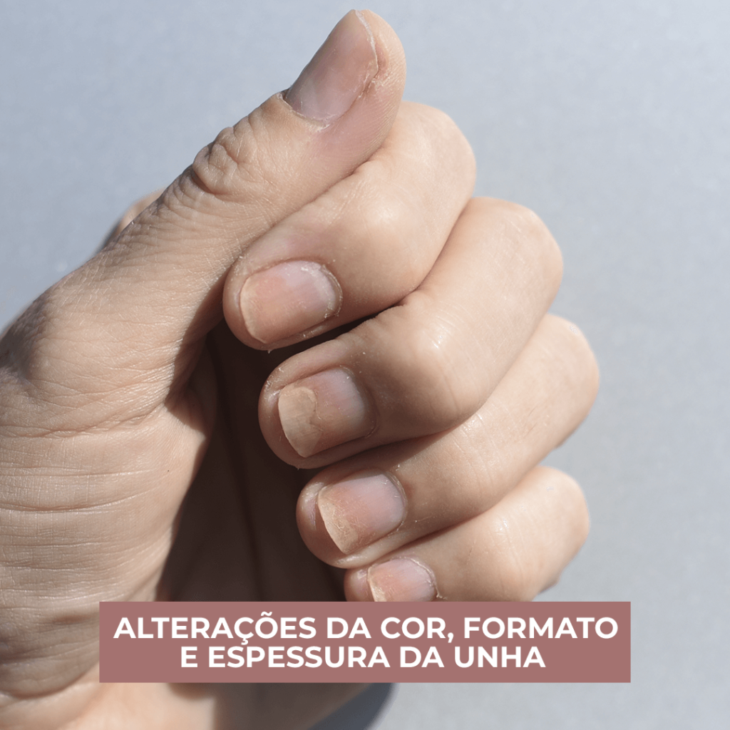 UNHAS-COR